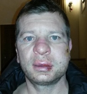 В Киеве бойцы «Беркута» жестоко избили и ограбили Пастриарха УПЦ МП