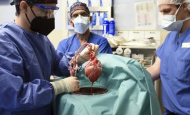 В США впервые человеку пересадили сердце свиньи