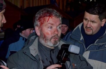 За время Евромайдана в Украине пострадали 136 журналистов