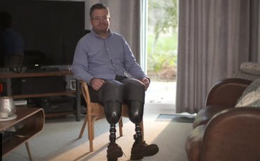 Британский хирург с ампутированными ногами снова делает операции