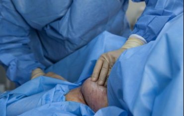 Хирург отрезал 22-летней британке две лишние груди