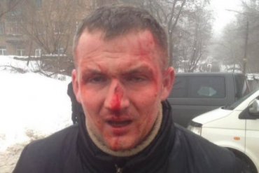 В Киеве избили нардепа Левченко