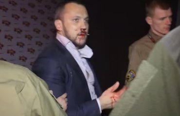 Депутаты подрались до крови после эфира на украинском ТВ