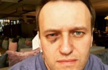 Навальному сделали операцию в Барселоне