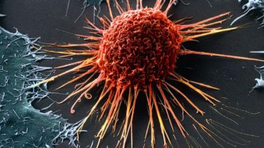 В Шотландии успешно испытали препарат, точечно убивающий раковые клетки