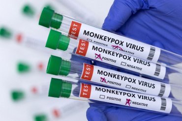 Первый случай оспы обезьян подтвердили в Чехии
