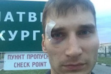 Боевики ДНР избили российского журналиста