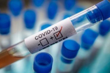Большинство украинцев верит, что коронавирус создали в лаборатории
