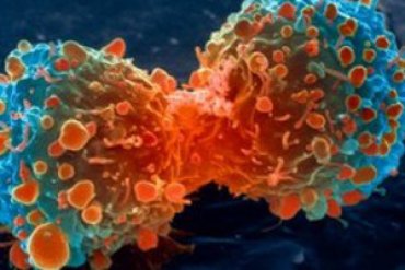 Ученые взялись за исследование природы рака легких