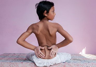 В Индии 12-летнего мальчика с хвостом признали божеством