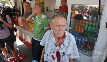 Торговцы шаурмой в Киеве разбили голову пожилому активисту