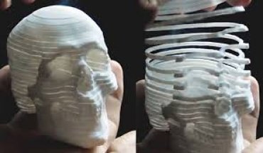 В Китае ребенку пересадили напечатанный на 3D-принтере череп