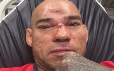 Бойцу из Бразилии на ринге проломили череп