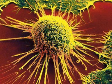 Ученые обнаружили новые молекулы, которые поражают раковые клетки, устойчивые к лекарствам