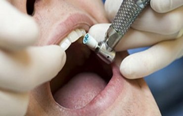 Эксперты сконструировали умный зуб, который будет наблюдать за здоровьем человека