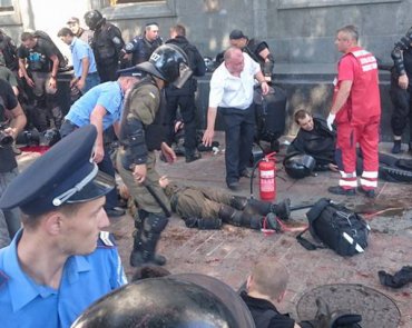 Взрыв под Радой: 50 раненых бойцов, 4 – на грани жизни и смерти