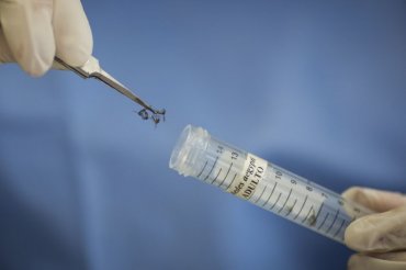 В США зафиксирован первый случай смерти от вируса Зика