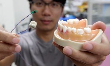 Изобретен «умный зуб», который будет следить за привычками людей