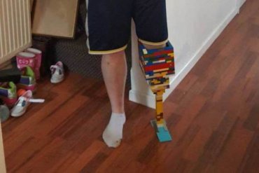 Британец сделал себе протез ноги из конструктора «Лего»