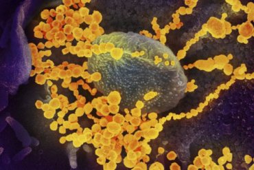 Ученые США обнаружили более заразную мутацию коронавируса