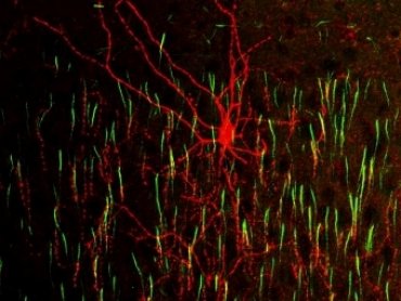 Нейробиологи установили происхождение клеток-канделябров