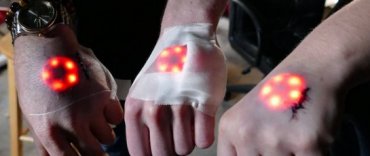 Биохакеры вживили под кожу имплант с подсветкой