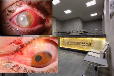 Выдавая себя за британскую клинику, офтальмологический центр в Киеве без разбору «режет» глаза пациентам