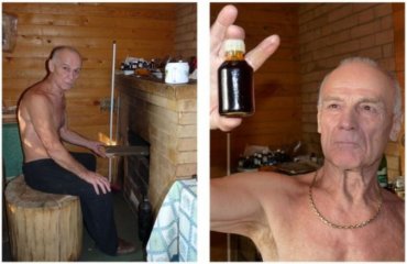 В Москве «народный целитель» в ходе сеанса лечения барсучьим жиром проломил бездетной пациентке голову
