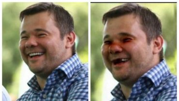 Богдан опубликовал фото с выбитыми зубами и синяками