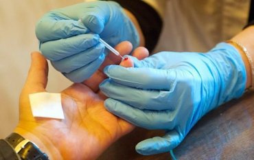 Впервые за 19 лет учеными обнаружен новый штамм ВИЧ