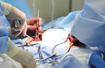 Во Франции проведена первая в мире операция по вживлению искусственного сердца