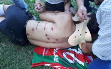 В Аргентине полицейские открыли огонь по футболистам