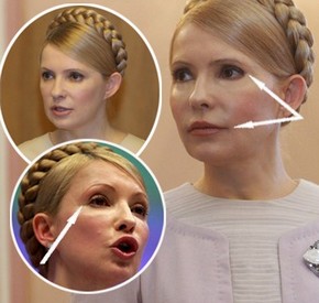 Тимошенко увеличила губы. Фото 