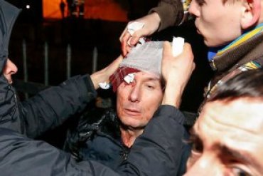 Врачи заявляют, что во время драки с «Беркутом» Луценко был пьян