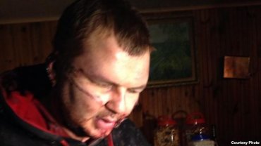 Милиция усиленно расследует похищение Дмитрия Булатова