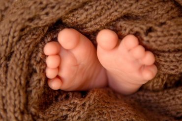 В Индии родился ребенок с двумя головами и тремя руками