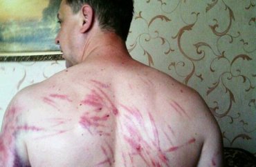 Боевики ДНР избили донецкого пастора