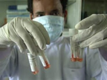 Открыт новый вирус оспы – потенциальное средство для биологического оружия