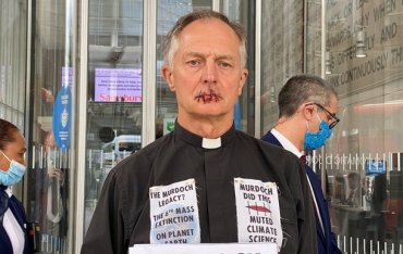 Британский священник в знак протеста зашил себе рот