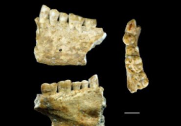 Ученые обнаружили древнейший запломбированный зуб