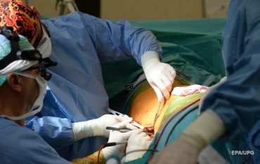 В Украине зафиксировали стоимость операций по пересадке органов