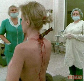 Девушке всадили нож в спину, а она не заметила. Фото LIFE News