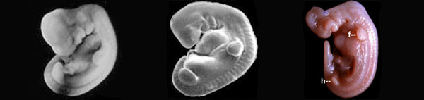 Патология жабер у человека. Жаберные дуги у человеческого эмбриона. Человеческий эмбрион с хвостом.