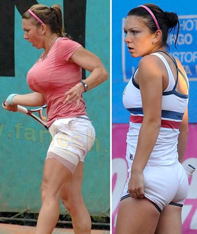 Симона Халеп до операции (фото слева) была одной из самых впечатляющих участниц любого теннисного турнира, а уменьшив грудь на три размера, превратилась в одну из многих заурядных теннисисток.